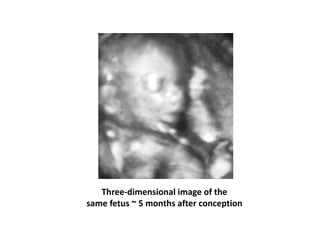 Three-dimensional image of the
same fetus ~ 5 months after conception
 