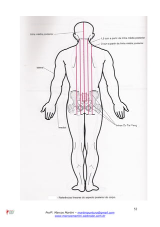 52
Profº. Marcos Martini – martinipuntura@gmail.com
www.marcosmartini.webnode.com.br
 