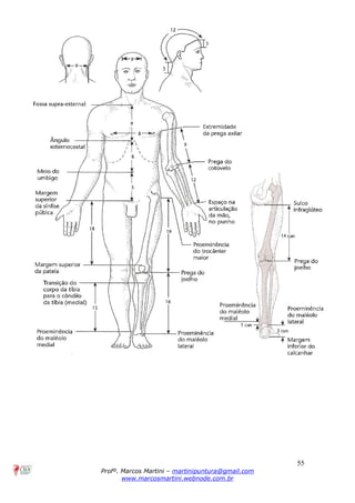 55
Profº. Marcos Martini – martinipuntura@gmail.com
www.marcosmartini.webnode.com.br
 