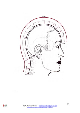 57
Profº. Marcos Martini – martinipuntura@gmail.com
www.marcosmartini.webnode.com.br
 