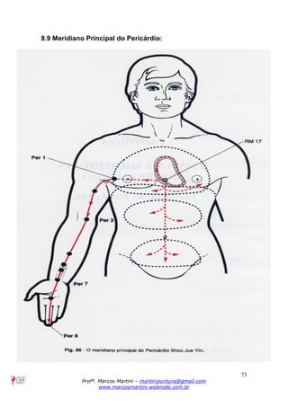 73
Profº. Marcos Martini – martinipuntura@gmail.com
www.marcosmartini.webnode.com.br
8.9 Meridiano Principal do Pericárdio:
 