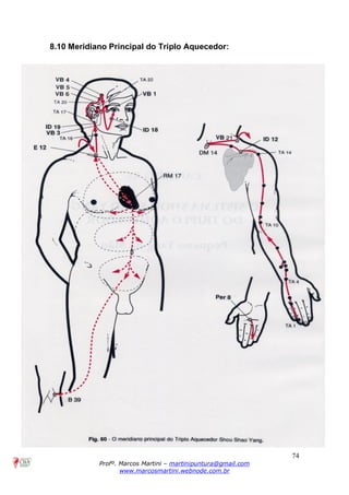 74
Profº. Marcos Martini – martinipuntura@gmail.com
www.marcosmartini.webnode.com.br
8.10 Meridiano Principal do Triplo Aquecedor:
 
