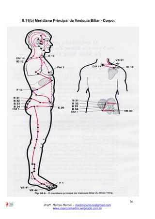 76
Profº. Marcos Martini – martinipuntura@gmail.com
www.marcosmartini.webnode.com.br
8.11(b) Meridiano Principal da Vesícula Biliar - Corpo:
 