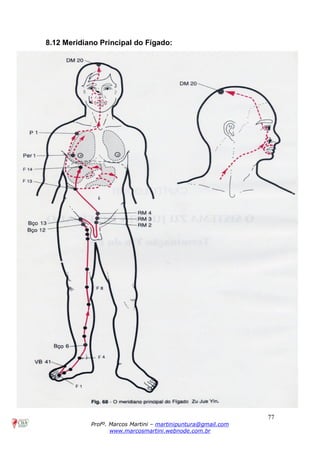 77
Profº. Marcos Martini – martinipuntura@gmail.com
www.marcosmartini.webnode.com.br
8.12 Meridiano Principal do Fígado:
 