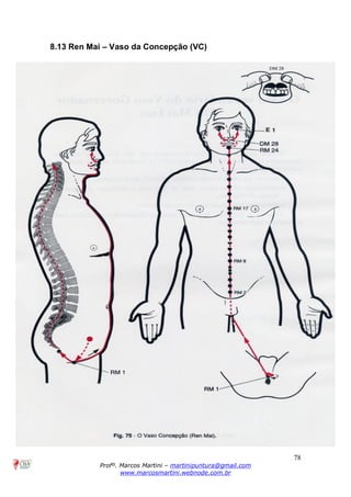 78
Profº. Marcos Martini – martinipuntura@gmail.com
www.marcosmartini.webnode.com.br
8.13 Ren Mai – Vaso da Concepção (VC)
 