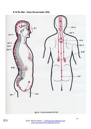 79
Profº. Marcos Martini – martinipuntura@gmail.com
www.marcosmartini.webnode.com.br
8.14 Du Mai - Vaso Governador (VG)
 