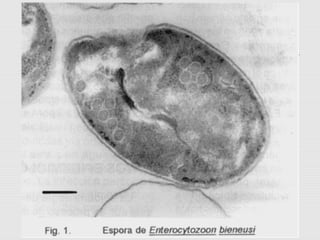 Microspora protozoologia