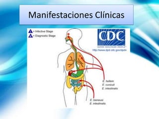 Manifestaciones Clínicas
 