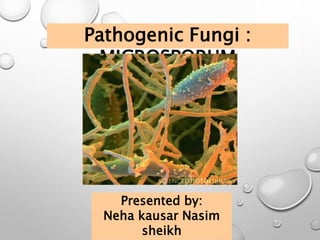 Pathogenic Fungi :
MICROSPORUM
Presented by:
Neha kausar Nasim
sheikh
 