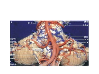 Microsurgical anatomy of fourth ventricle | PPTX
