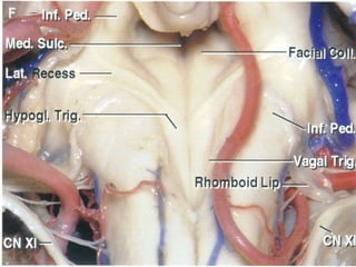 Microsurgical anatomy of fourth ventricle | PPTX
