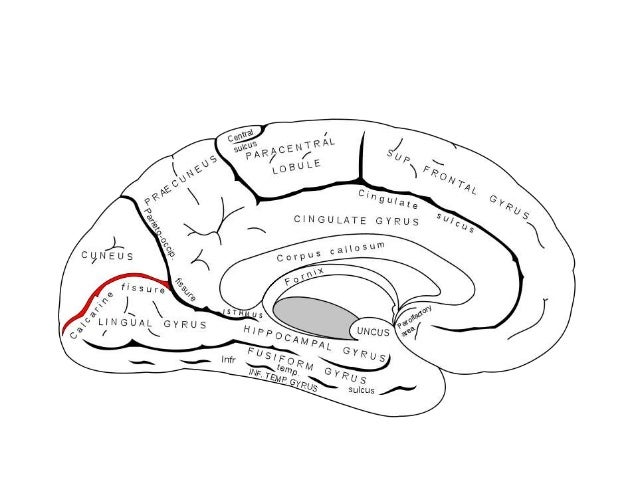 Microsurgical anatomy of lateral ventricles