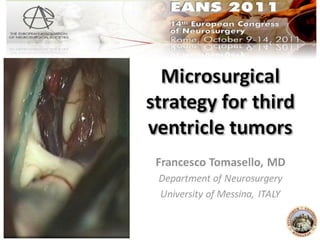 Microsurgical strategy for third ventricle tumors