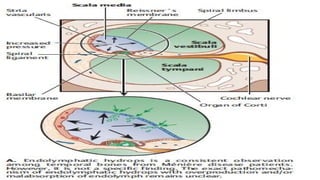 micro teaching vestibular disorder and defect on system vestibular | PPTX