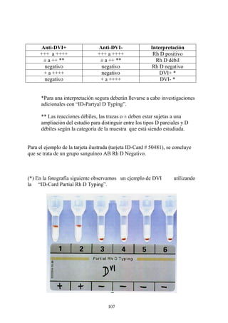 107
Anti-DVI+ Anti-DVI- Interpretación
+++ a ++++ +++ a ++++ Rh D positivo
± a ++ ** ± a ++ ** Rh D débil
negativo negativo Rh D negativo
+ a ++++ negativo DVI+ *
negativo + a ++++ DVI- *
*Para una interpretación segura deberán llevarse a cabo investigaciones
adicionales con “ID-Partyal D Typing”.
** Las reacciones débiles, las trazas o ± deben estar sujetas a una
ampliación del estudio para distinguir entre los tipos D parciales y D
débiles según la categoría de la muestra que está siendo estudiada.
Para el ejemplo de la tarjeta ilustrada (tarjeta ID-Card # 50481), se concluye
que se trata de un grupo sanguíneo AB Rh D Negativo.
(*) En la fotografía siguiente observamos un ejemplo de DVI utilizando
la “ID-Card Partial Rh D Typing”.
 