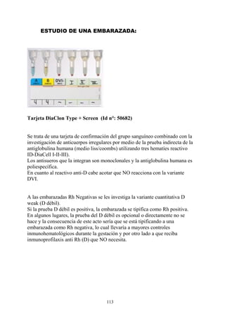 113
ESTUDIO DE UNA EMBARAZADA:
Tarjeta DiaClon Type + Screen (Id n°: 50682)
Se trata de una tarjeta de confirmación del grupo sanguíneo combinado con la
investigación de anticuerpos irregulares por medio de la prueba indirecta de la
antiglobulina humana (medio liss/coombs) utilizando tres hematíes reactivo
ID-DiaCell I-II-III).
Los antisueros que la integran son monoclonales y la antiglobulina humana es
poliespecífica.
En cuanto al reactivo anti-D cabe acotar que NO reacciona con la variante
DVI.
A las embarazadas Rh Negativas se les investiga la variante cuantitativa D
weak (D débil).
Si la prueba D débil es positiva, la embarazada se tipifica como Rh positiva.
En algunos lugares, la prueba del D débil es opcional o directamente no se
hace y la consecuencia de este acto sería que se está tipificando a una
embarazada como Rh negativa, lo cual llevaría a mayores controles
inmunohematológicos durante la gestación y por otro lado a que reciba
inmunoprofilaxis anti Rh (D) que NO necesita.
 