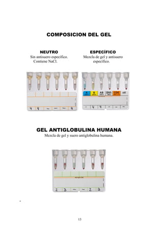 13
COMPOSICION DEL GEL
NEUTRO ESPECÍFICO
Sin antisuero específico. Mezcla de gel y antisuero
Contiene NaCl. específico.
GEL ANTIGLOBULINA HUMANA
Mezcla de gel y suero antiglobulina humana.
 