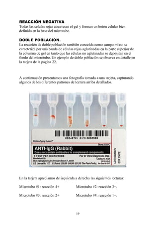 19
REACCIÓN NEGATIVA
Todas las células rojas atraviesan el gel y forman un botón celular bien
definido en la base del microtubo.
DOBLE POBLACIÓN.
La reacción de doble población también conocida como campo mixto se
caracteriza por una banda de células rojas aglutinadas en la parte superior de
la columna de gel en tanto que las células no aglutinadas se depositan en el
fondo del microtubo. Un ejemplo de doble población se observa en detalle en
la tarjeta de la página 22.
A continuación presentamos una fotografía tomada a una tarjeta, capturando
algunos de los diferentes patrones de lectura arriba detallados.
En la tarjeta apreciamos de izquierda a derecha las siguientes lecturas:
Microtubo #1: reacción 4+ Microtubo #2: reacción 3+.
Microtubo #3: reacción 2+ Microtubo #4: reacción 1+.
 