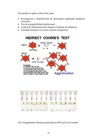 38
Esta prueba se aplica, entre otros, para:
 Investigación e identificación de anticuerpos empleando antígenos
conocidos.
 Test de compatibilidad transfusional.
 Control de aloinmunización durante el período de embarazo.
 Fenotipar hematíes en ciertos sistemas antigénicos.
Test Antiglobulina Humana practicado en ID-Card Liss/Coombs
 