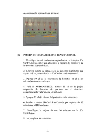 46
A continuación se muestra un ejemplo:
II) PRUEBA DE COMPATIBILIDAD TRANSFUSIONAL.
1. Identifique los microtubos correspondientes en la tarjeta ID-
Card “LISS/Coombs” con el nombre o número del receptor y de
la muestra a compatibilizar.
2. Retire la lámina de sellado sólo de aquellos microtubos que
vaya a utilizar, manteniendo la ID-Card en posición vertical.
3. Pipetee 50 µl de la suspensión de hematíes en el o los
microtubos correspondientes.
4. Para el AUTOCONTROL, pipetee 50 µl de la propia
suspensión de hematíes del paciente en el microtubo
correspondiente y claramente identificado.
5. Agregue 25 µl del plasma del paciente a cada microtubo.
6. Incube la tarjeta ID-Card Liss/Coombs por espacio de 15
minutos en el ID-Incubator.
7. Centrifugue la tarjeta durante 10 minutos en la ID-
Centrifugue.
8. Lea y registre los resultados.
 