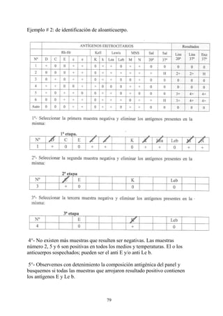 79
Ejemplo # 2: de identificación de aloanticuerpo.
4°- No existen más muestras que resulten ser negativas. Las muestras
número 2, 5 y 6 son positivas en todos los medios y temperaturas. El o los
anticuerpos sospechados; pueden ser el anti E y/o anti Le b.
5°- Observemos con detenimiento la composición antigénica del panel y
busquemos si todas las muestras que arrojaron resultado positivo contienen
los antígenos E y Le b.
 