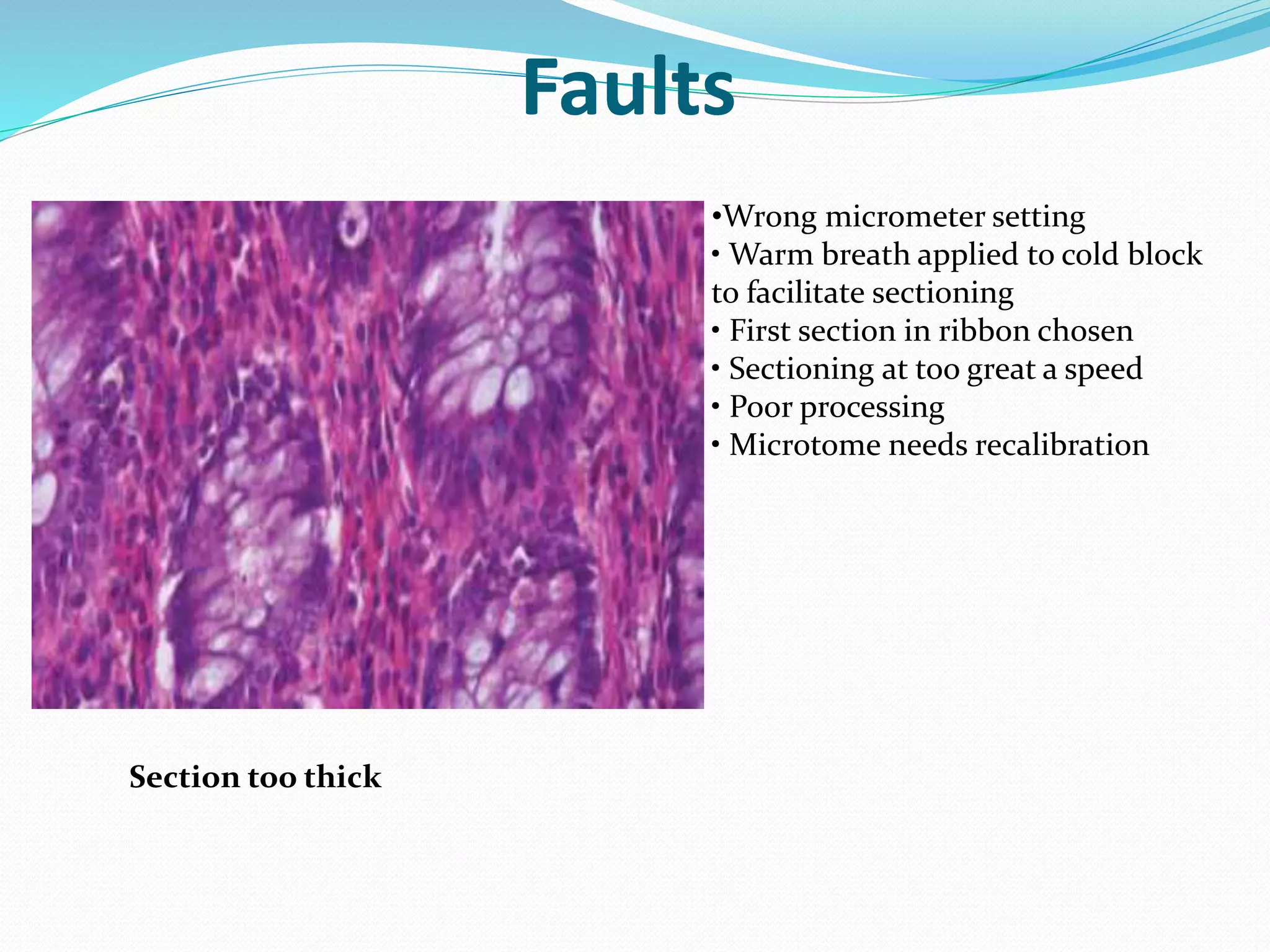 Faults
Section too thick
•Wrong micrometer setting
• Warm breath applied to cold block
to facilitate sectioning
• First section in ribbon chosen
• Sectioning at too great a speed
• Poor processing
• Microtome needs recalibration
 
