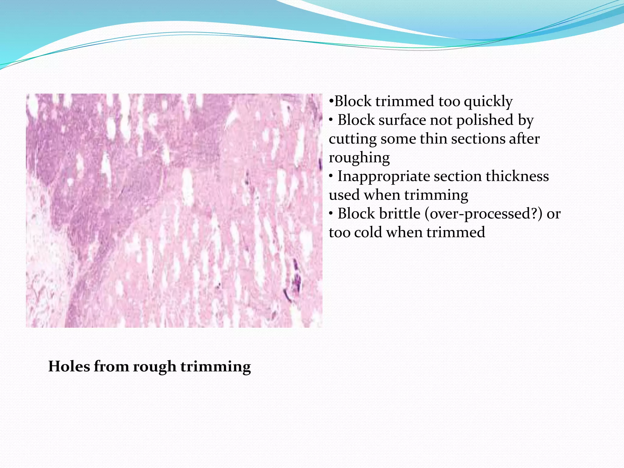 Holes from rough trimming
•Block trimmed too quickly
• Block surface not polished by
cutting some thin sections after
roughing
• Inappropriate section thickness
used when trimming
• Block brittle (over-processed?) or
too cold when trimmed
 