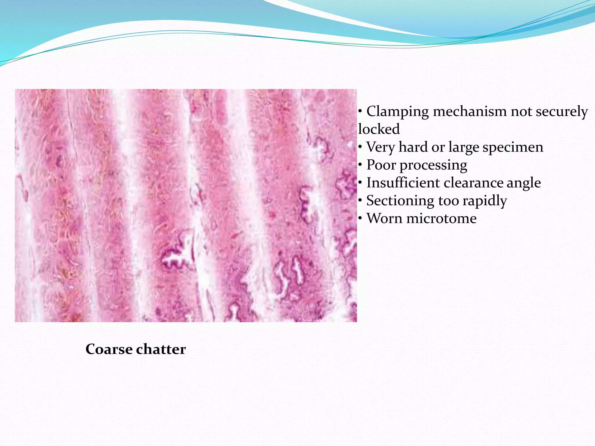 Coarse chatter
• Clamping mechanism not securely
locked
• Very hard or large specimen
• Poor processing
• Insufficient clearance angle
• Sectioning too rapidly
• Worn microtome
 