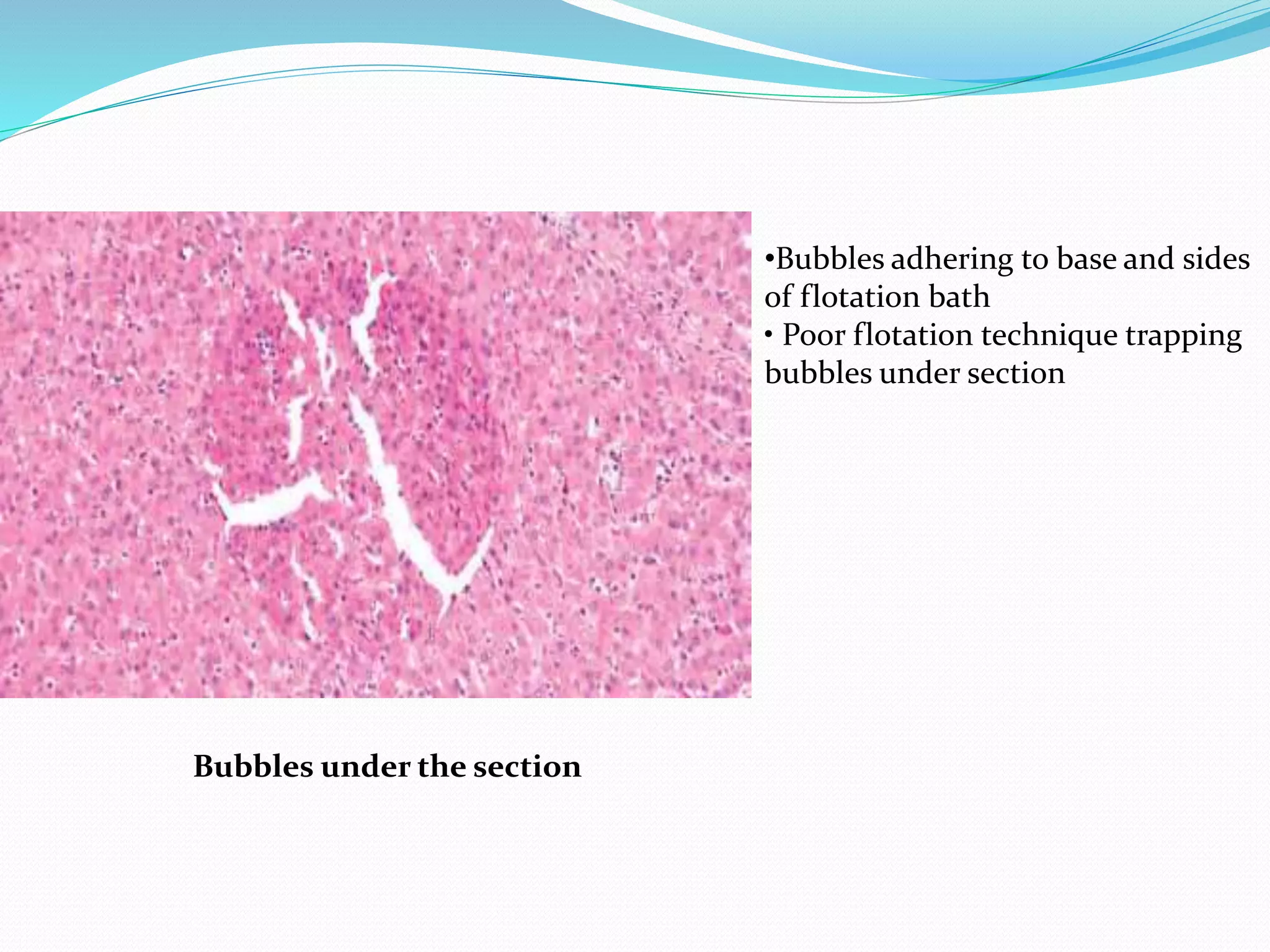 Bubbles under the section
•Bubbles adhering to base and sides
of flotation bath
• Poor flotation technique trapping
bubbles under section
 