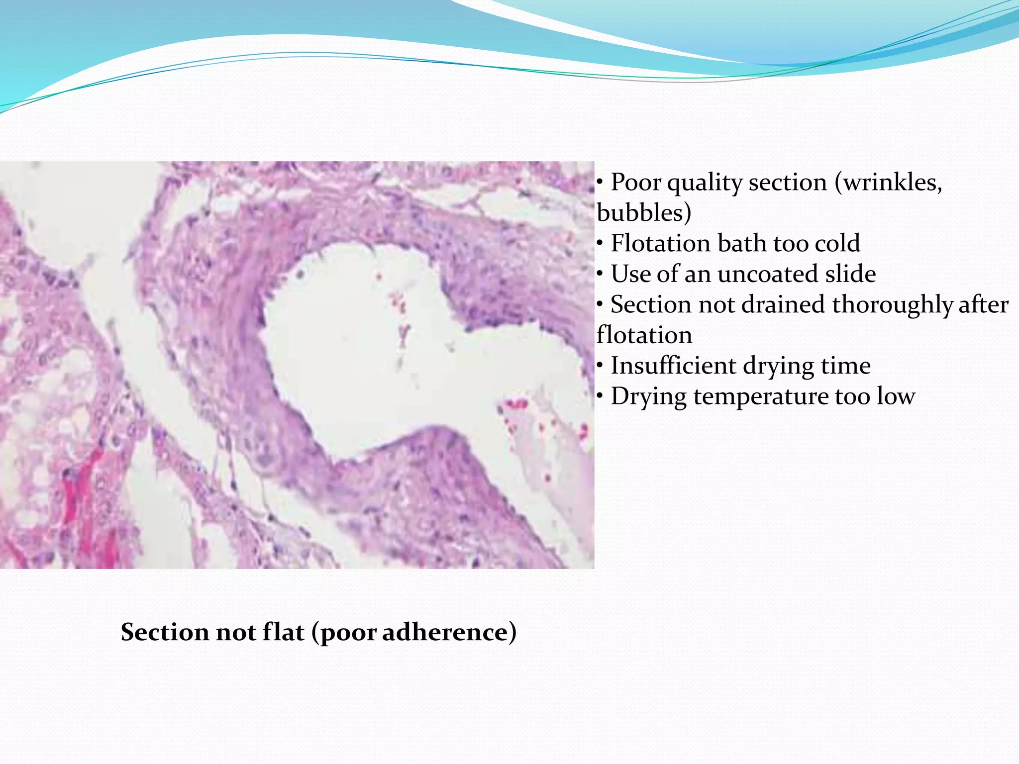 Section not flat (poor adherence)
• Poor quality section (wrinkles,
bubbles)
• Flotation bath too cold
• Use of an uncoated slide
• Section not drained thoroughly after
flotation
• Insufficient drying time
• Drying temperature too low
 