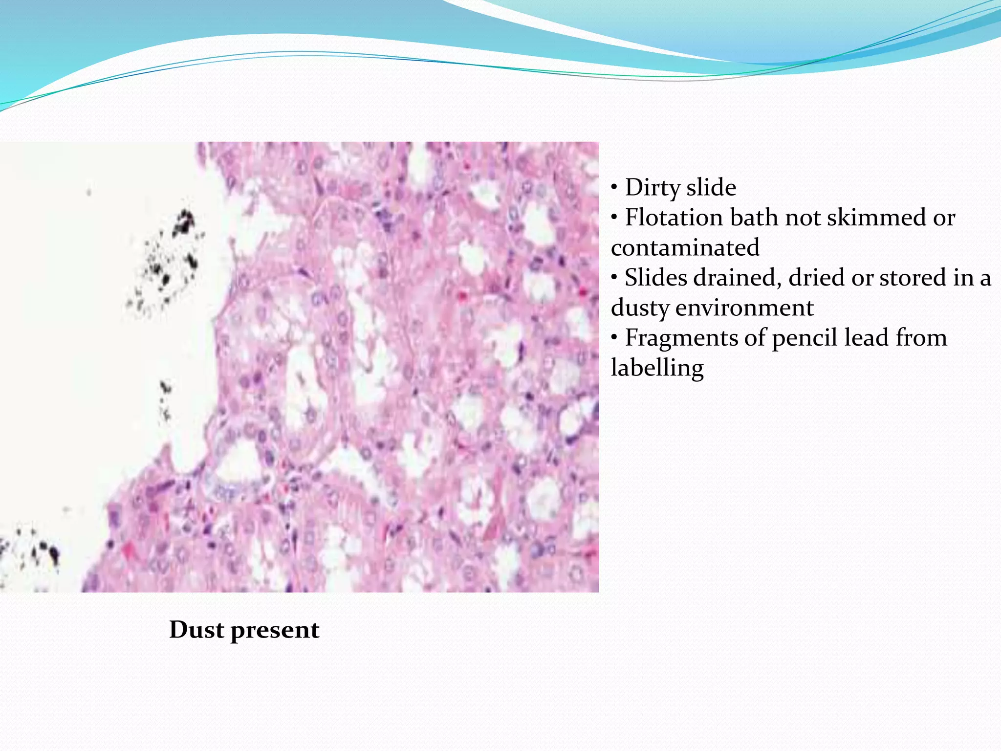 Dust present
• Dirty slide
• Flotation bath not skimmed or
contaminated
• Slides drained, dried or stored in a
dusty environment
• Fragments of pencil lead from
labelling
 