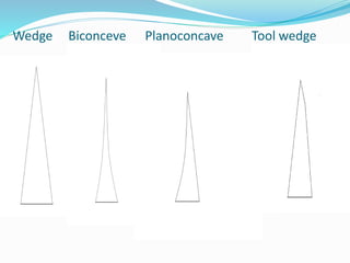 Wedge Biconceve Planoconcave Tool wedge
 