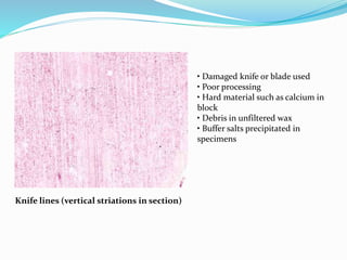 Knife lines (vertical striations in section)
• Damaged knife or blade used
• Poor processing
• Hard material such as calcium in
block
• Debris in unfiltered wax
• Buffer salts precipitated in
specimens
 