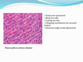 Fine cracks or micro-chatter
• Tissue over-processed
• Block too cold
• Cutting too fast
• Clamping mechanism not securely
locked
• Clearance angle needs adjustment
 