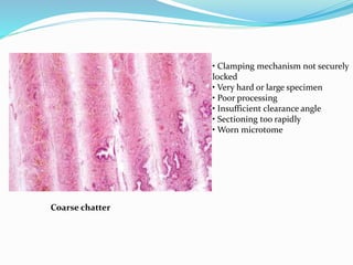 Coarse chatter
• Clamping mechanism not securely
locked
• Very hard or large specimen
• Poor processing
• Insufficient clearance angle
• Sectioning too rapidly
• Worn microtome
 