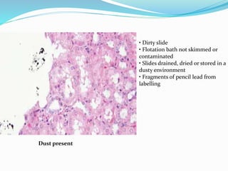 Dust present
• Dirty slide
• Flotation bath not skimmed or
contaminated
• Slides drained, dried or stored in a
dusty environment
• Fragments of pencil lead from
labelling
 