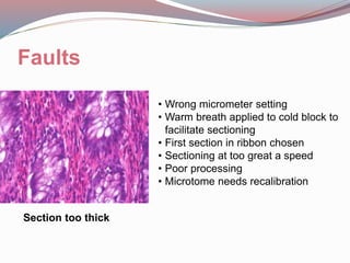Faults
Section too thick
• Wrong micrometer setting
• Warm breath applied to cold block to
facilitate sectioning
• First section in ribbon chosen
• Sectioning at too great a speed
• Poor processing
• Microtome needs recalibration
 