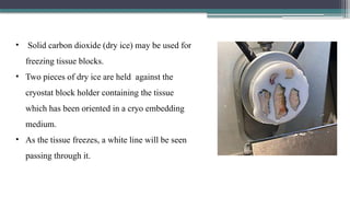 • Solid carbon dioxide (dry ice) may be used for
freezing tissue blocks.
• Two pieces of dry ice are held against the
cryostat block holder containing the tissue
which has been oriented in a cryo embedding
medium.
• As the tissue freezes, a white line will be seen
passing through it.
 