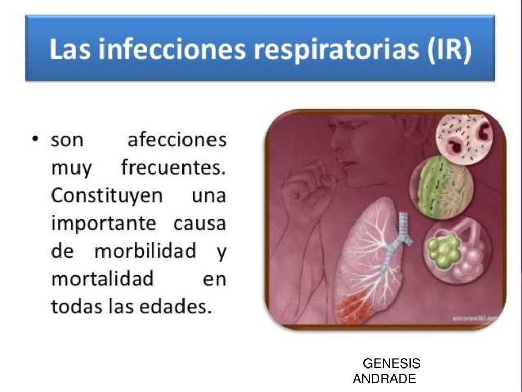 Infecciones Del Tracto Respiratorio Superior, Agentes Causales y sus Infecciones Del Tracto Respiratorio Superior, Agentes Causales y sus