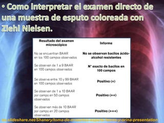 es.slideshare.net/Shanery/toma-de-muestras-esputo-heces-y-orina-presentation
 