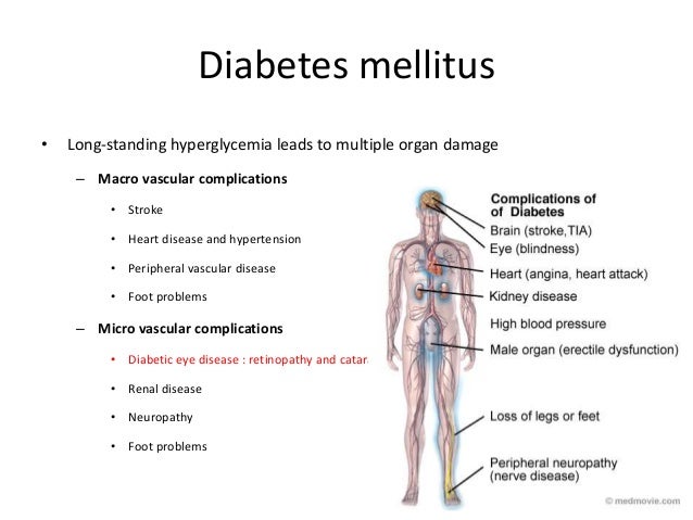 Diabetesmicrovascularcomplications 20170420 Ahc Diabetesmicrovascularcomplications 20170420 Ahc