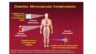 MICROVASCULAR COMPLICATIONS OF diabetes mellitus | PPTX