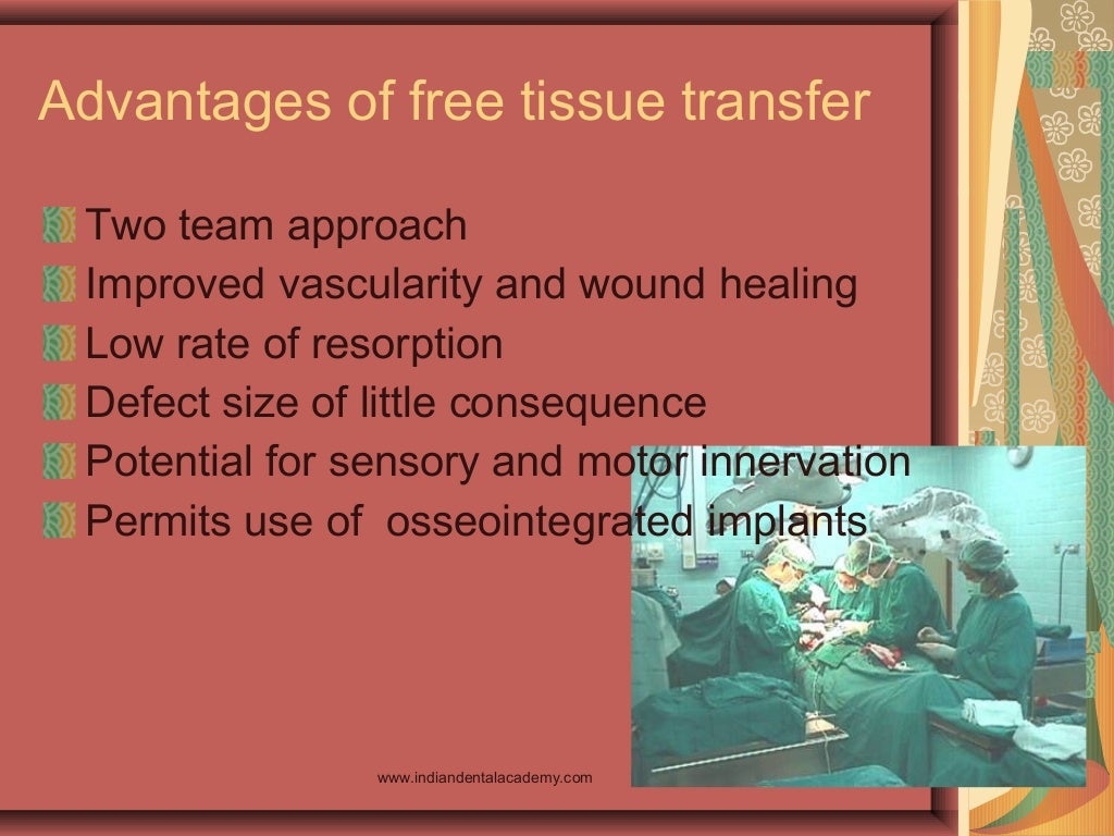 Microvascular free tissue transfer /certified fixed orthodontic cours…