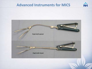 Minimally invasive cardiac surgery | PPTX