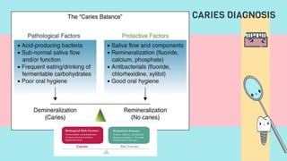 CARIES DIAGNOSIS
 