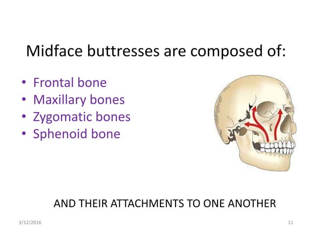 Mid facial fractures and their management | PPTX