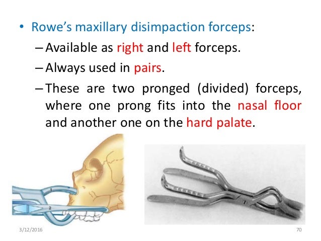 Mid facial fractures and their management
