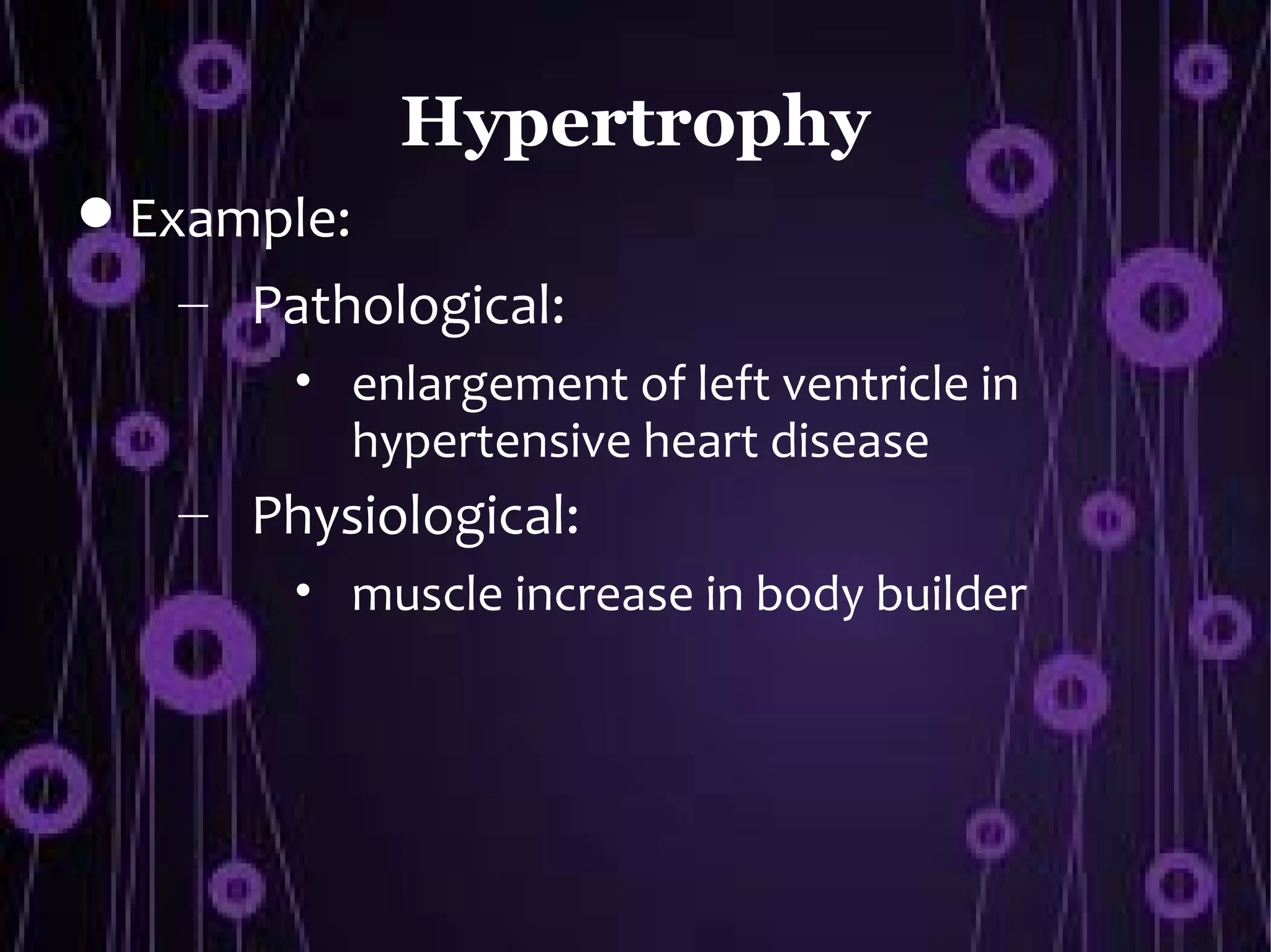 Hypertrophy
 Example:
   – Pathological:
       • enlargement of left ventricle in
         hypertensive heart disease
   – Physiological:
       • muscle increase in body builder
 