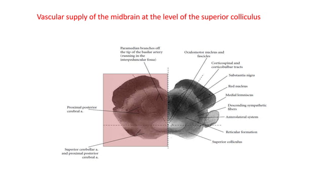 Mid brain anatomy and vascular syndromes | PPTX | Brain and Nervous ...