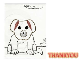 Midbrain-Neuroradiology